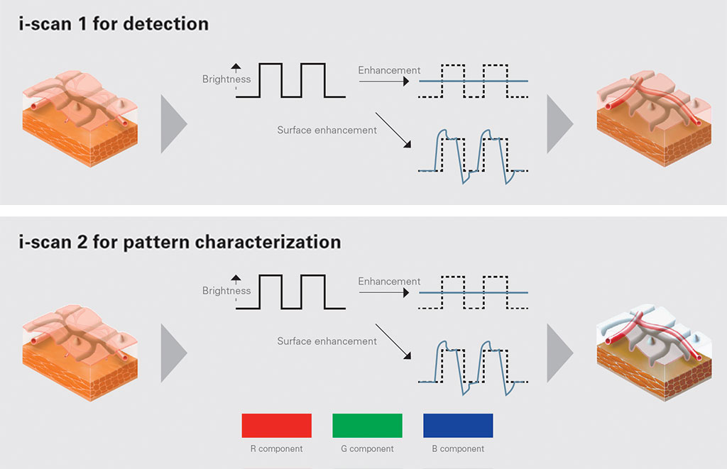 Enhanced Detection and Characterization with i-scan